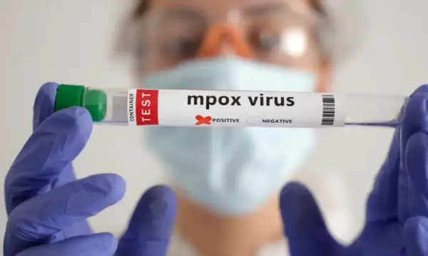Mpox: África tem quase 50 mil casos confirmados