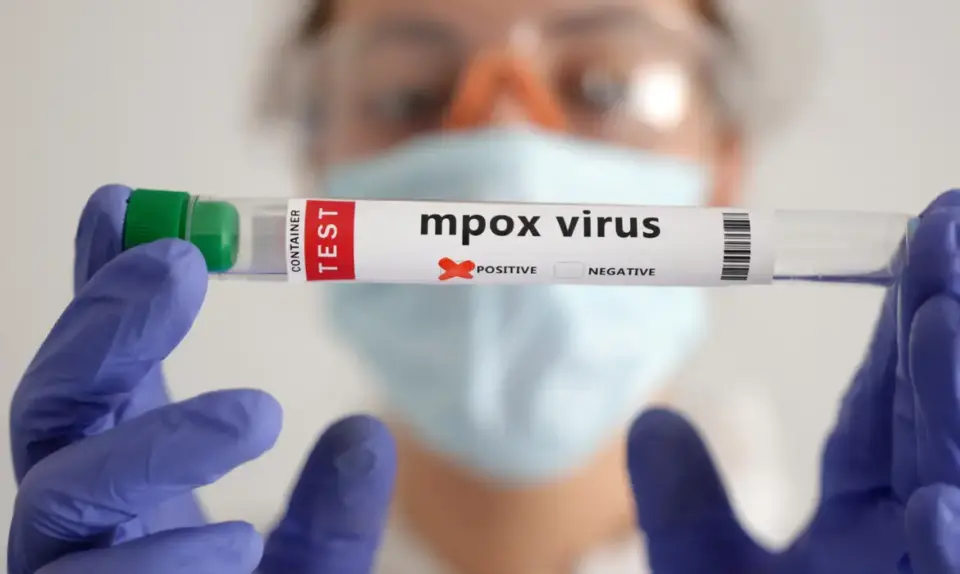 Mpox: África tem quase 50 mil casos confirmados