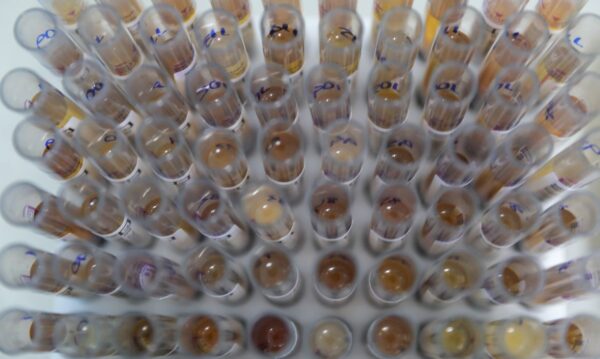 Uso de medicamento oferecido no SUS reduz casos de malária no Brasil