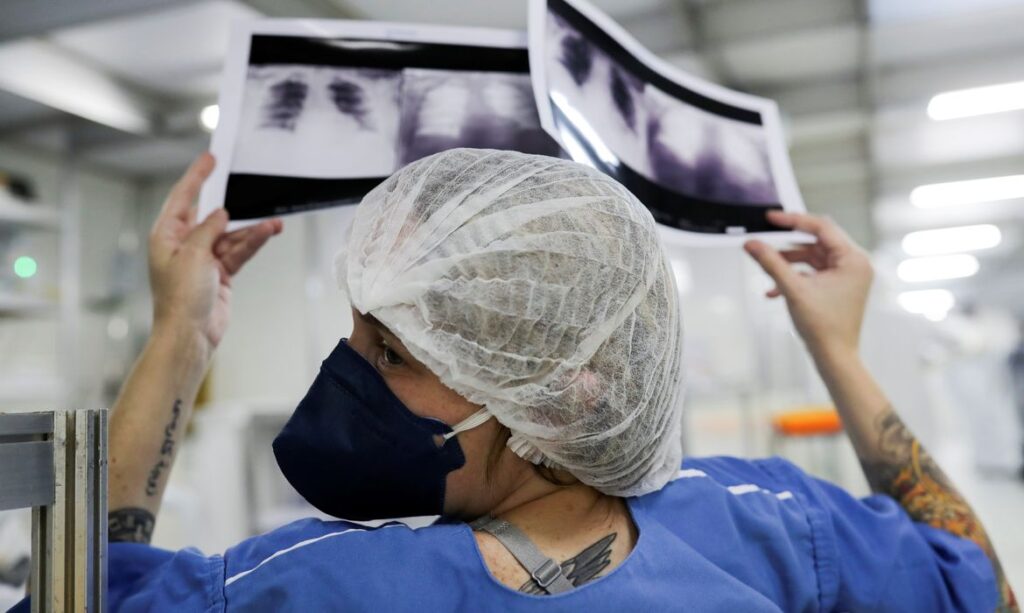 Diagnóstico tardio dá poucas chances de cura para o câncer de pulmão Diagnóstico tardio dá poucas chances de cura para o câncer de pulmão